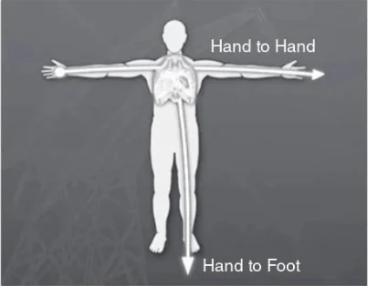 Current which crosses vital organs can cause serious internal injuries or death.